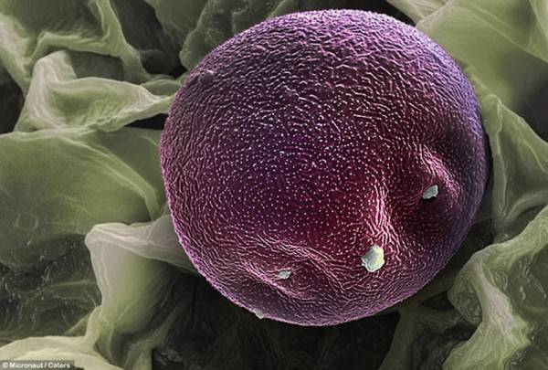 Look into the face of the enemy. - Pollen, Allergy, Pollinosis, The photo, Beautiful, Longpost, Microfilming