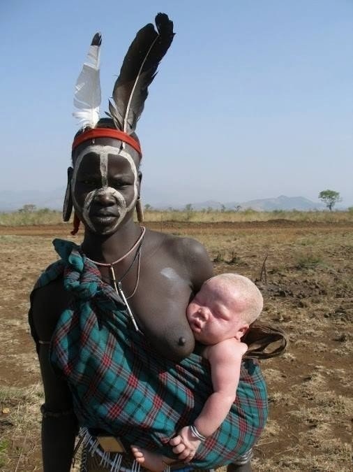 Help identify the origin of a photograph - NSFW, My, The photo, Africa, Ethnos, Albino, People, Story