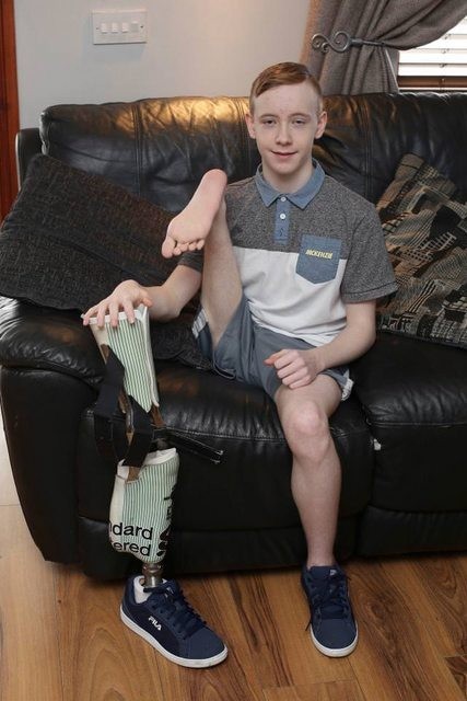 Doctors sew teenager's leg back on to make him a footballer - The medicine, Teenagers, sewn on, Vice versa, Video, Longpost