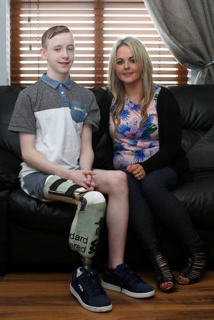 Doctors sew teenager's leg back on to make him a footballer - The medicine, Teenagers, sewn on, Vice versa, Video, Longpost