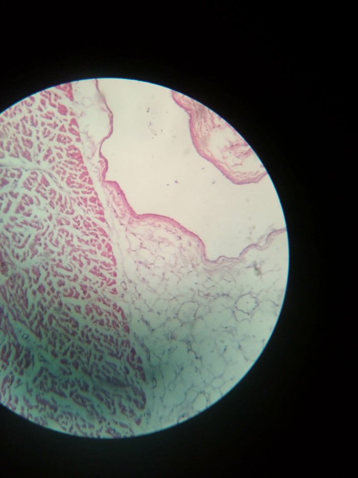 Photo from a microscope - Microscope, Heart, My, Person