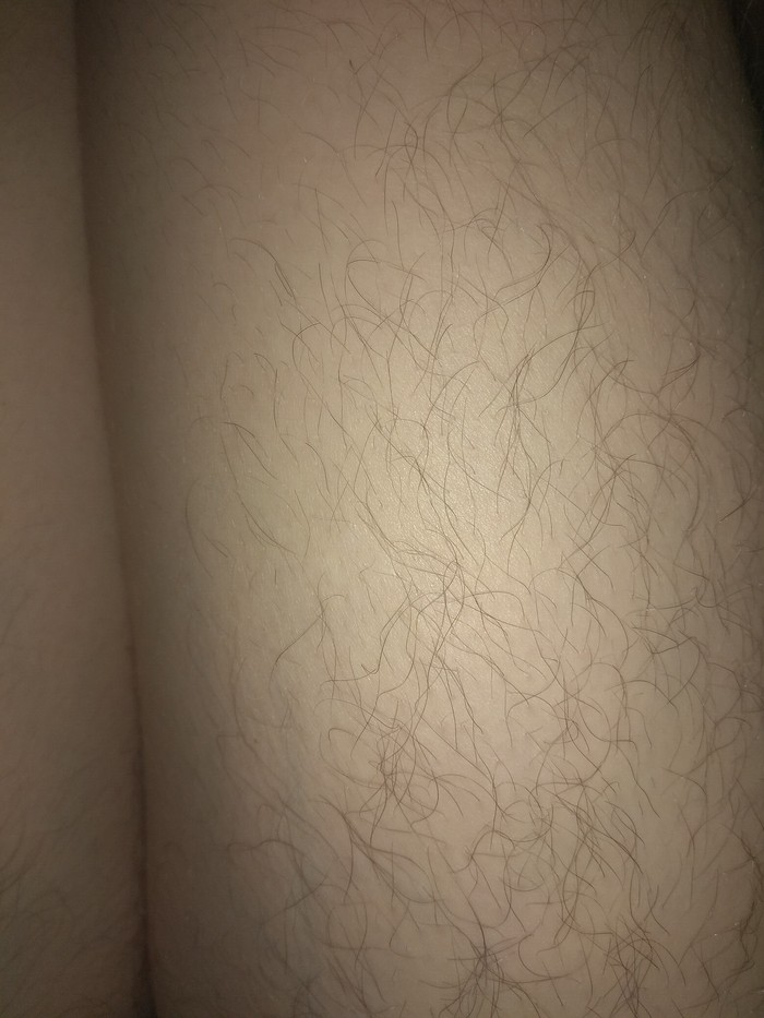 My hairy thigh. - My, Body positive, Hair, Legs, , Ideally