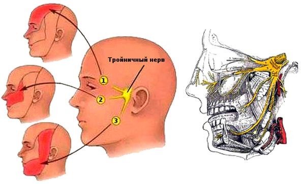 Trigeminal neuralgia. - The medicine, Information, Trigeminal nerve, Wednesday, The photo, Neuralgia, Longpost