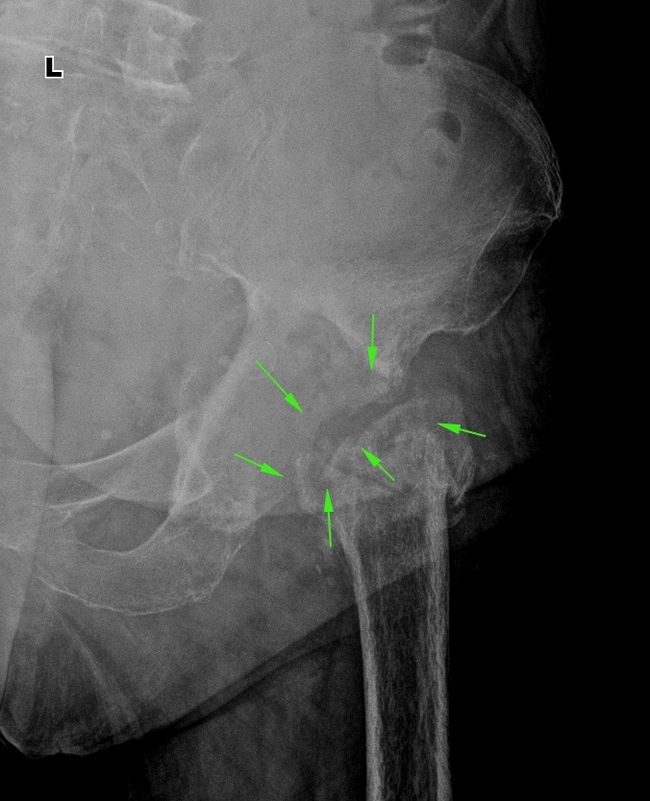 From the life of a radiologist. Part 17 - My, X-ray, Radiology, The medicine, Longpost