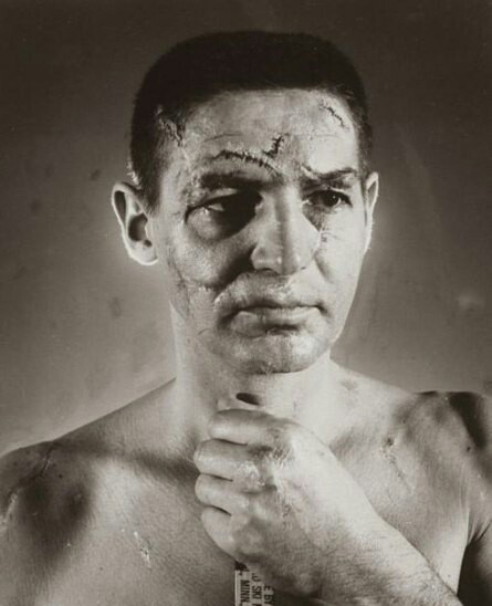 Terry Savchuk, goaltender for the Canadian Toronto Maple Leafs hockey team before the introduction of protective masks, 1966 - From the network, Coward does not play hockey, Scar, Hockey