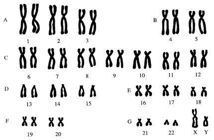 A little about our genetics and diseases. - Longpost, Genome, The science, Education, , Genetics, My, Genetic diseases