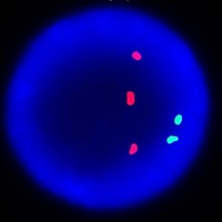 A little about important points and mosaicism. - My, Genetics, Education, , The science, Genome, Longpost, , Chimera, Genetic diseases