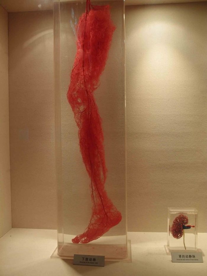 Circulatory system - , Shanghai, The photo, The medicine, Longpost, Anatomy