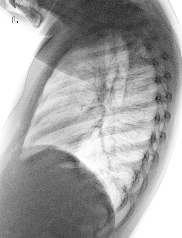 From the life of a radiologist. Part 19 - My, X-ray, The medicine, Longpost, The photo