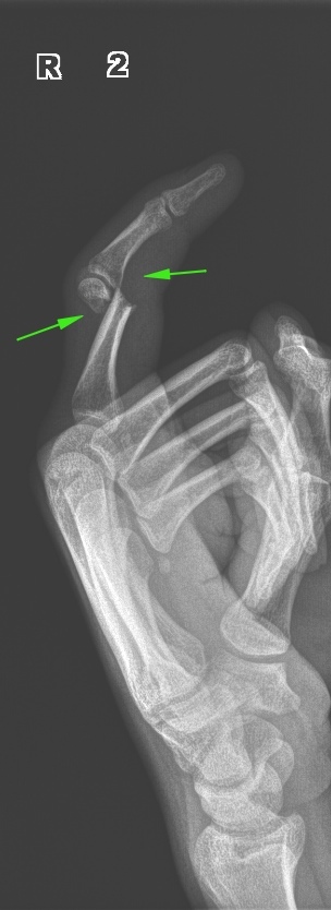 From the life of a radiologist. Part 19 - My, X-ray, The medicine, Longpost, The photo