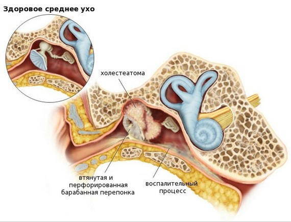 Continuation of the post about the ear) - My, Hospital, Operation, Longpost