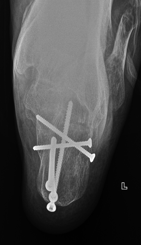 From the life of a radiologist. Part 22. Traumatic. - My, X-ray, The medicine, Longpost