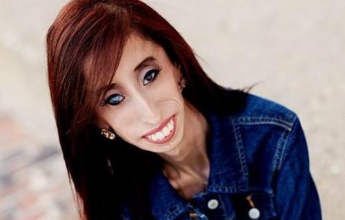 The story of Lizzie Velasquez, a woman with a rare disease - , Disease, Real life story, Change the life, Longpost, , A life