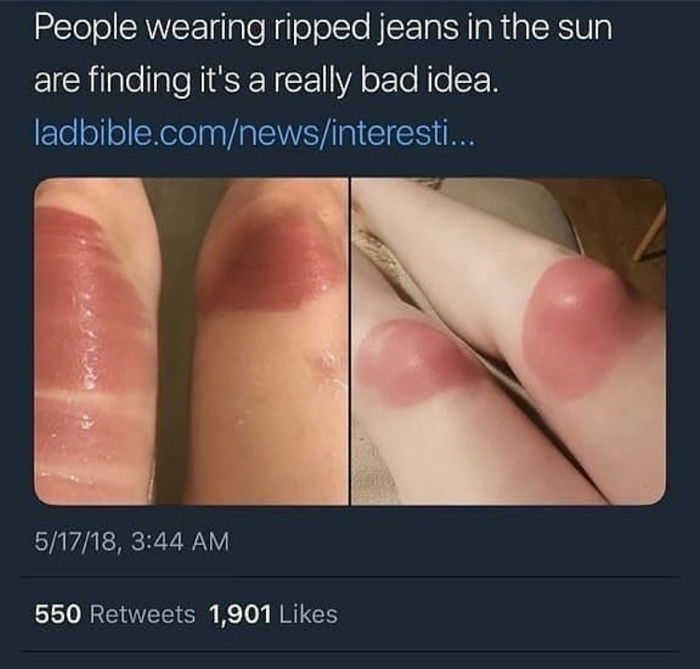 People who wear ripped jeans in the sun... - Failure, Ripped jeans, Jeans, Fail, Sunburn, Pain