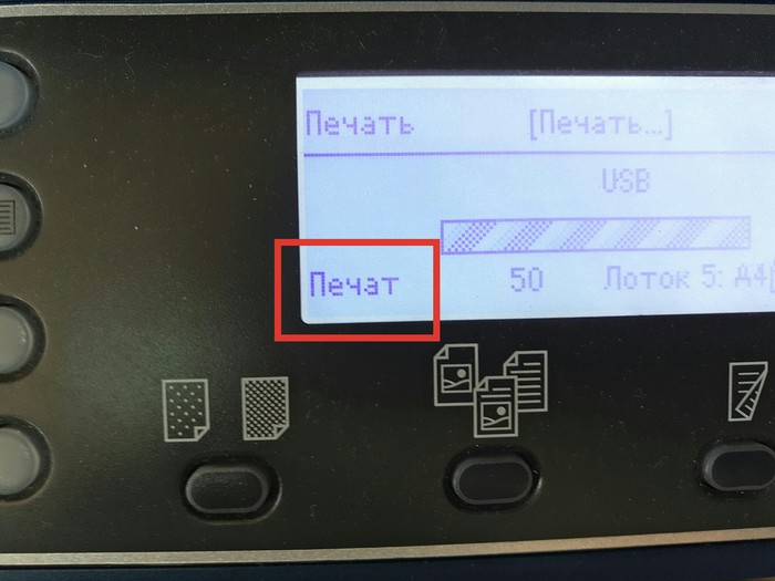 Л - локализация