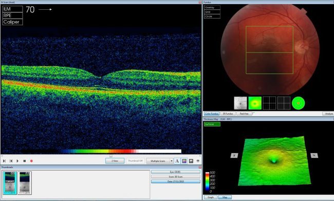 Scientists have created a neural network that can determine the presence of various eye diseases from a picture of the retina - Нейронные сети, The medicine, Vision, Google, DeepMind, Technologies