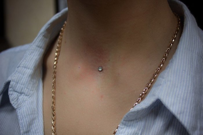 Who will explain to me what is beautiful, cool in microdermals and why this nonsense should be done? - , Fashion, Why