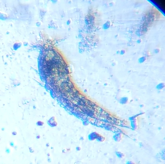 Peekaboo, help identify who it is) - My, Microbiology, The photo, Identification