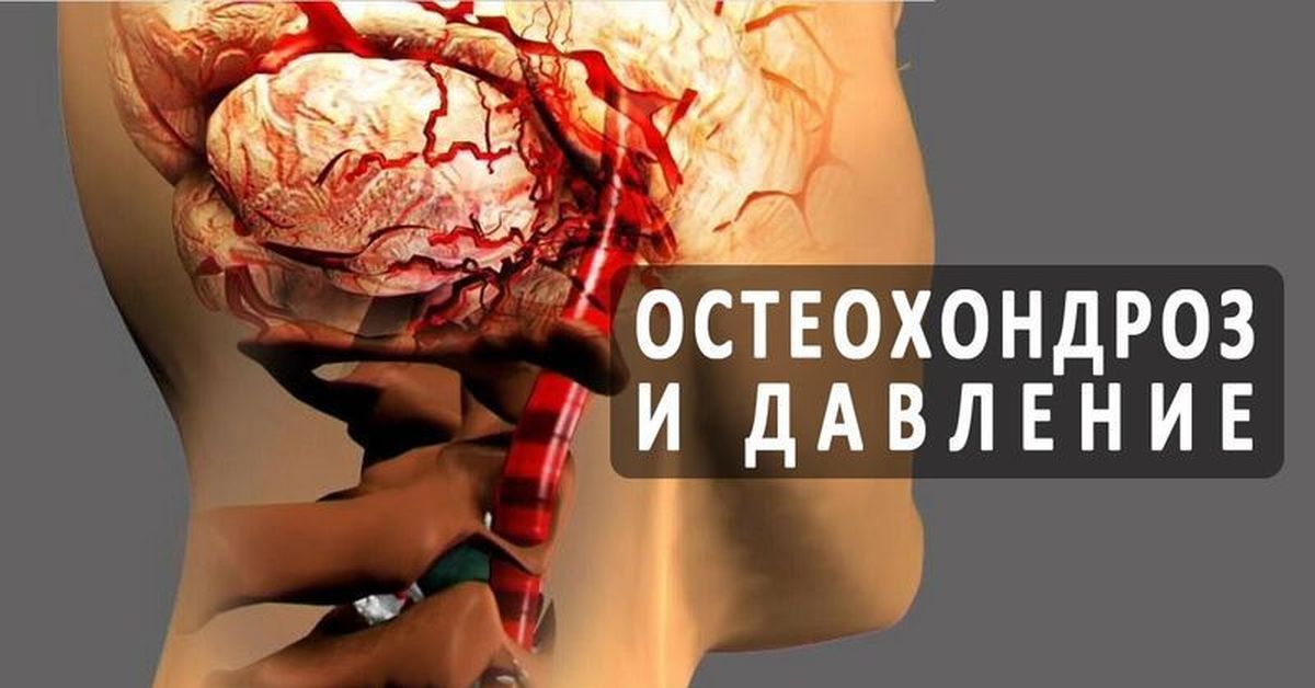 Может ли повышаться давление от шейного остеохондроза. Остеохондроз. Остеохондроз и давление. Давление при остеохондрозе шейного. Шейный остеохондроз и гипертония.