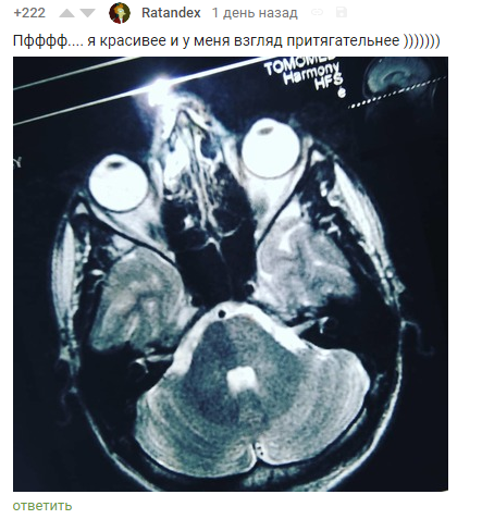 Photogenicity is everything! - Screenshot, Comments, Comments on Peekaboo, MRI, Snapshot, Photogenic, Longpost, The photo