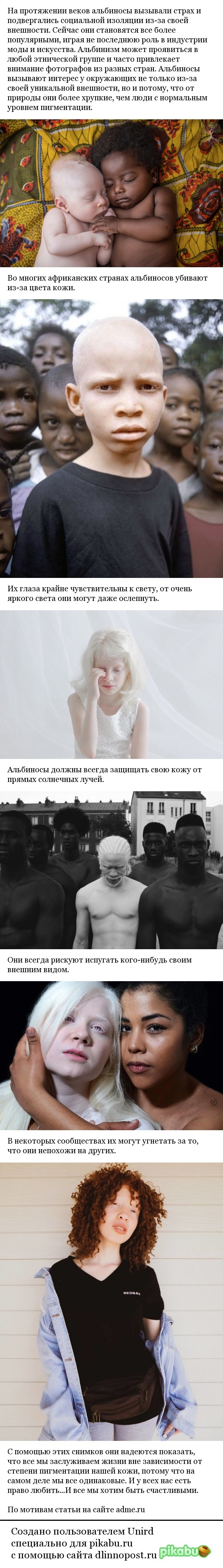 Albinos are among us. - A life, People, Society, The photo, Longpost, To think, Thoughts