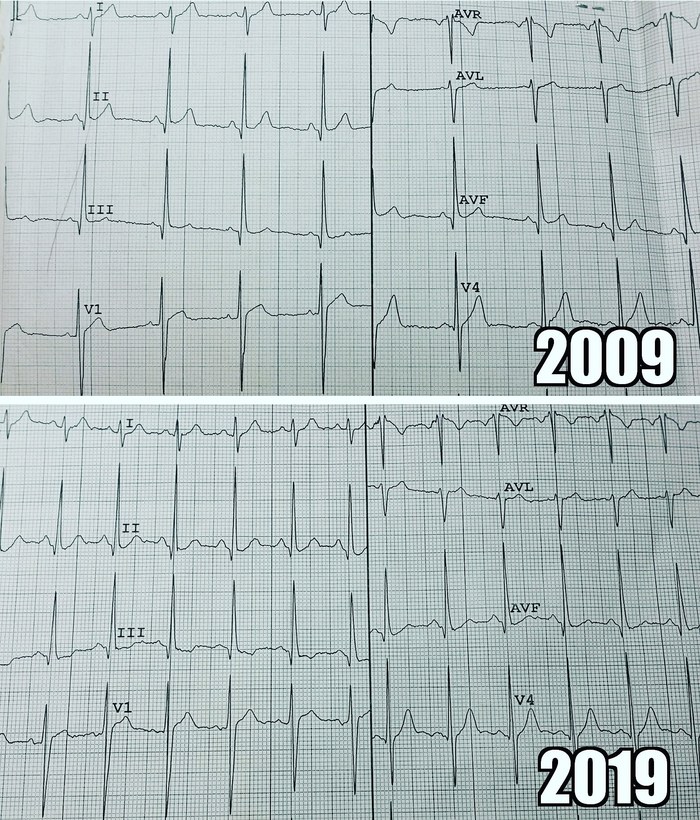 My #10yearschallenge - My, Health, 10yearschallenge