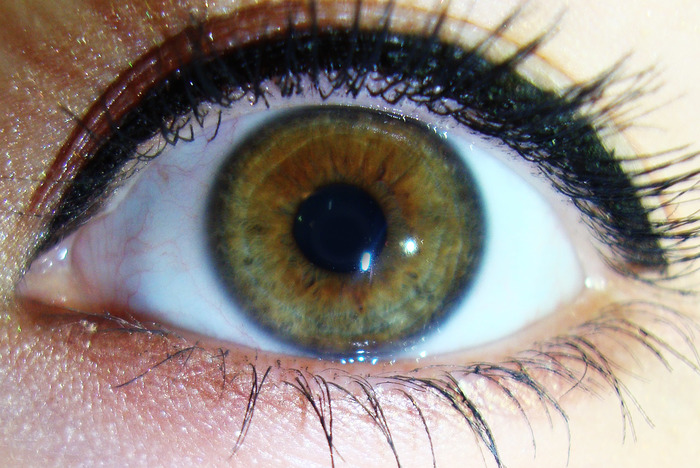 Зеленые глаза с коричневым ободком вокруг зрачка