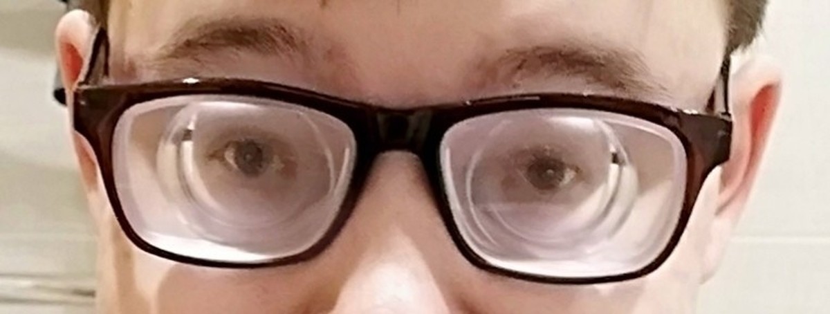 Почему дали в очках. Очки для близорукости. В очках с большими диоптриями. Очки для больших диоптрий. Очки с огромными линзами.