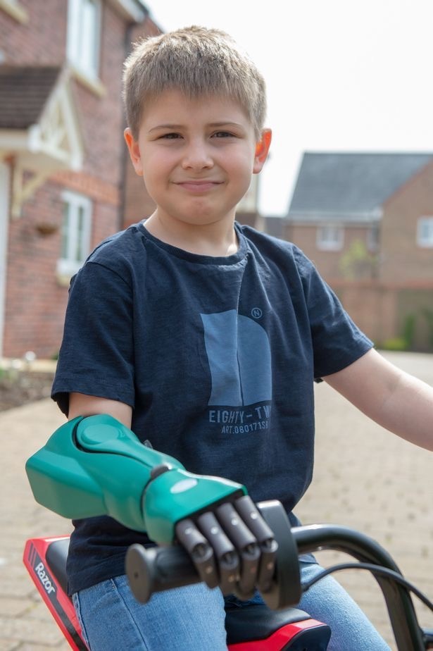 Young iron man - Hand, Prosthesis, Longpost, Children, Disabled person