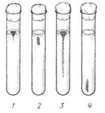 The normal microbiome of the female vagina is part of the immune system. - NSFW, My, Microbiology, Lactobacilli, Hiv, Microbiome, Interesting, Longpost