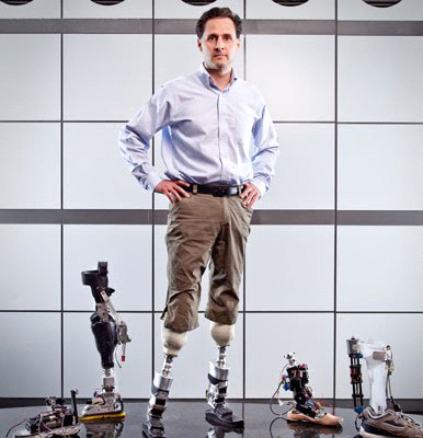 Bionic prosthetics - My, Prosthetics, Bionics, Bionic prosthesis, Biomechanics, Nauchpop, The science, Ted, Video, Longpost