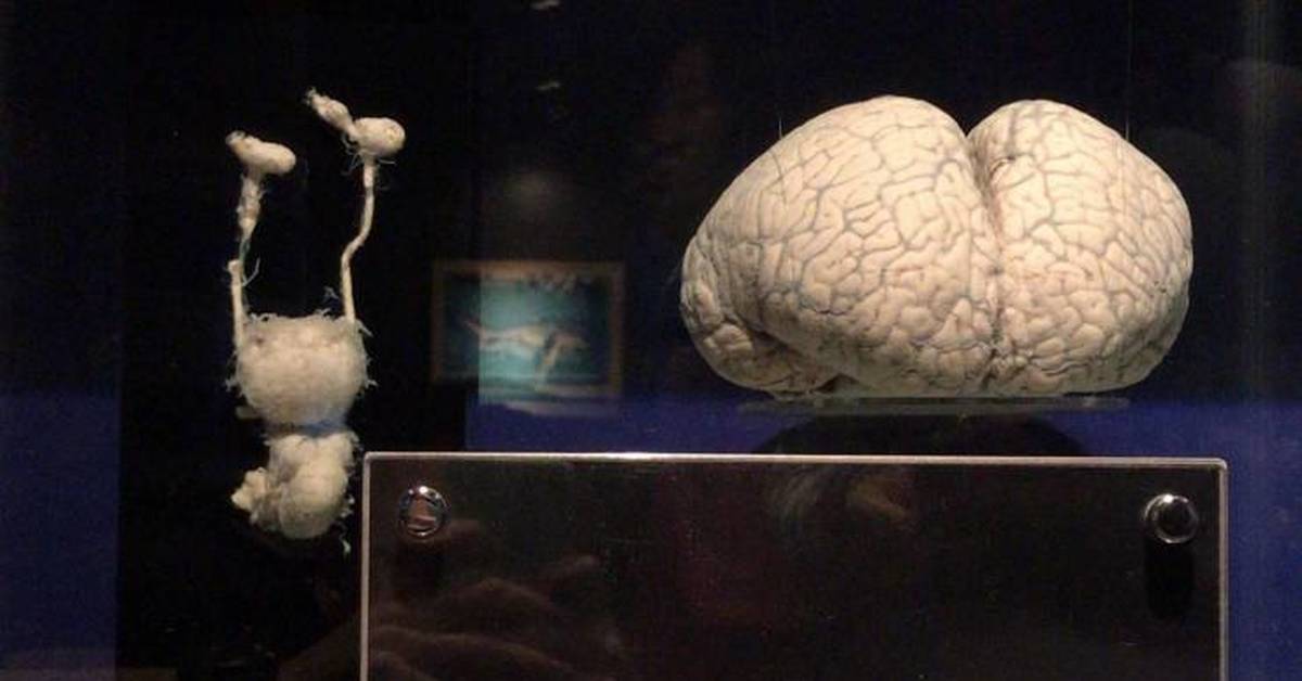 Какой мозг акулы. Мозг акулы. Мозг дельфина мозг акулы. Размер мозга белой акулы.