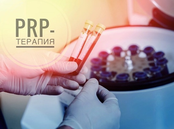 PRP-терапия: она работает? - Моё, Медицина, Здоровье, Длиннопост