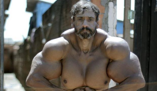 Bulbosaurus from Brazil: A former drug addict injects himself with oil. - Jock, Synthol, Longpost
