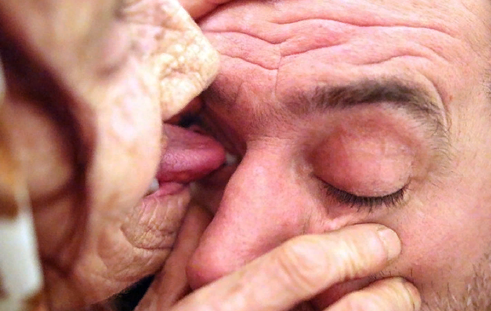 Бабушка лизнёт глаз чтобы ты не болел! Босния и Герцеговина, Нетрадиционная медицина