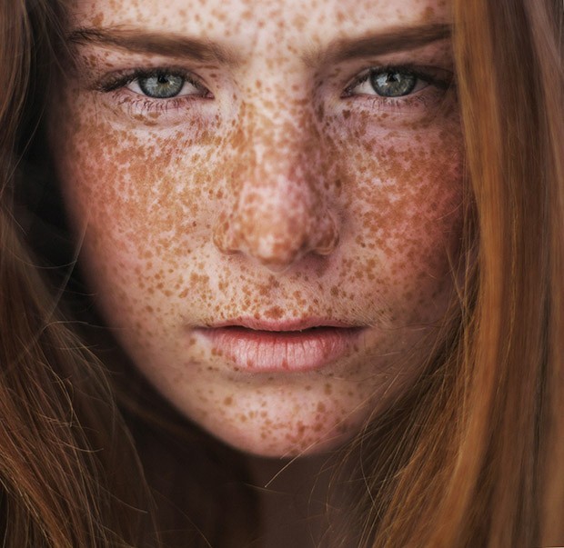 The sun loves them - Freckles, Girls, Face, Eyes, Redheads, The sun, Summer, Longpost