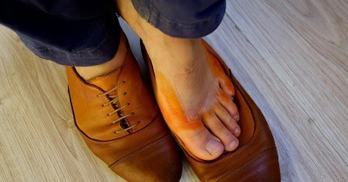 Красится обувь изнутри что делать. Оранжевые ступни. Ступни оранжевого цвета. Ноги окрасились от ботинок.