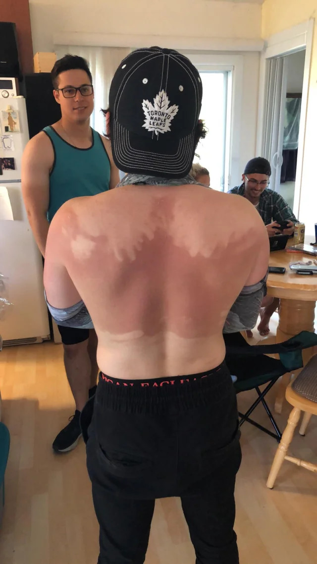 Он отказался от помощи в нанесении солнцезащитного крема , и вот результат Загар, Солнцезащитный крем, Reddit