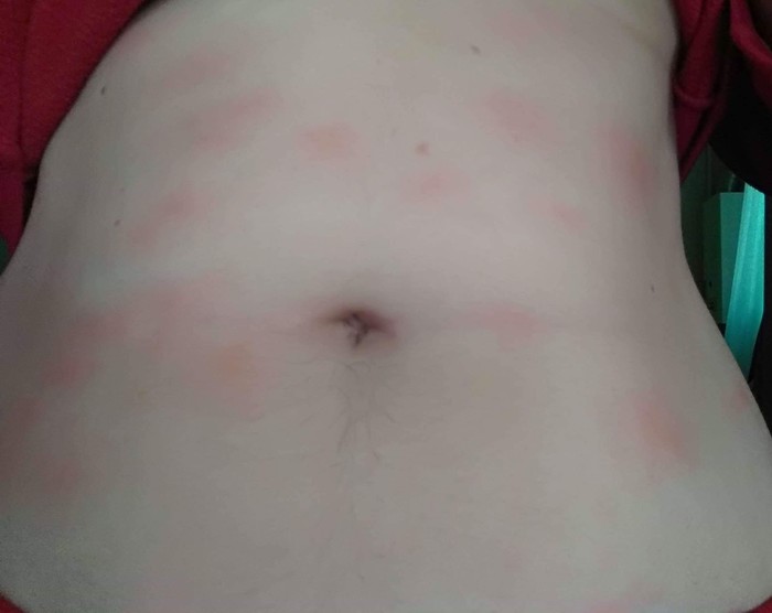 What is this game? - My, Stains, Doctors need help, , Dermatology, Rash