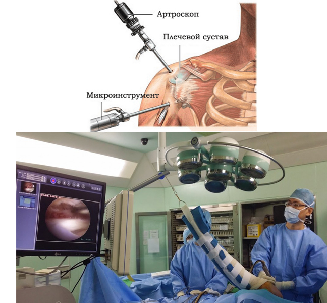 Arthroscopy - My, The medicine, Medicine in Russia, Longpost, Arthroscopy