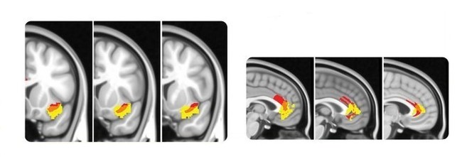 Trying to understand consciousness - Consciousness, Personality, Neurobiology, Psychology, Neuropsychology, Awareness, Longpost