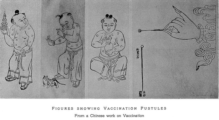 Дата изобретения прививки от оспы
