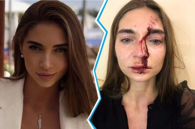 A Siberian woman got into a fight with a cosmetologist in a Moscow beauty salon: one got her face bleeding, the other was taken into custody - Girls, Cosmetology, Doctors, Fight, Negative, Beauty saloon, Video, Longpost