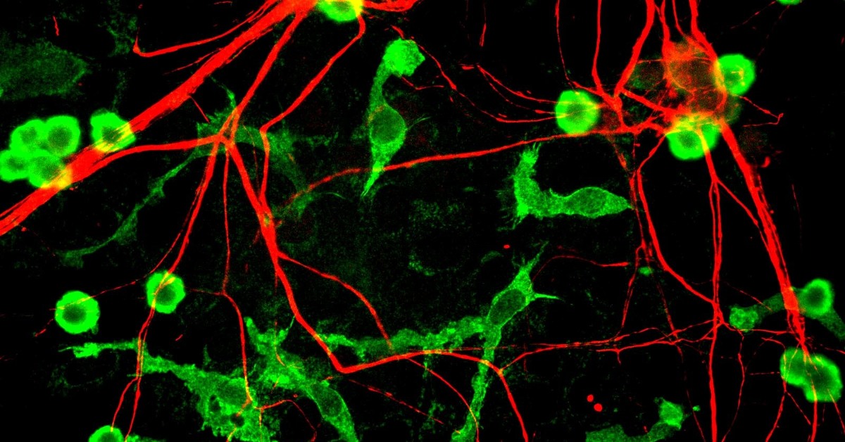 Эндотелиальные клетки мозга. Нейроны зеленый цвет. Нейроны красного цвета. Иммунные клетки мозга