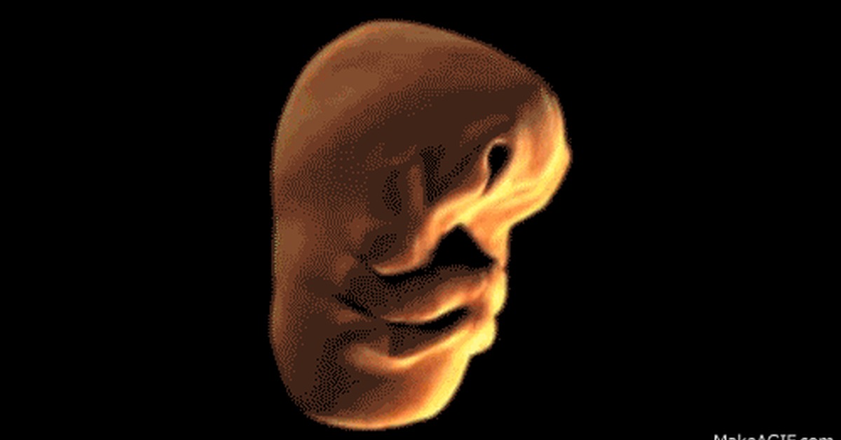 Formation of the face of a human fetus - My, Person, The medicine, GIF