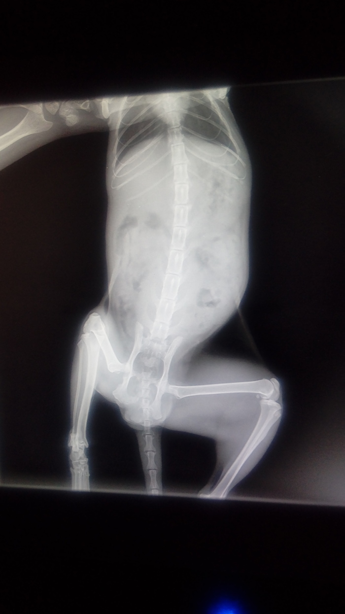 Перелом мизинца на ноге рентген фото