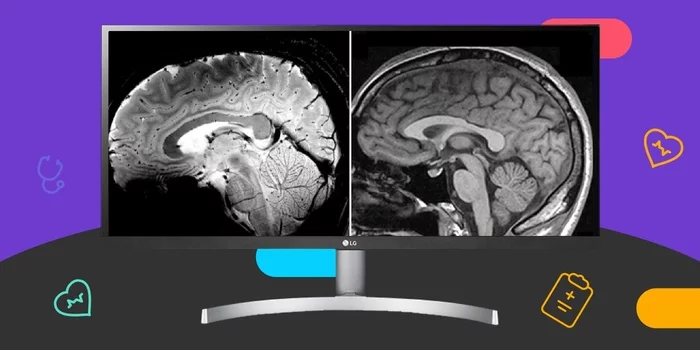 Краткая история медицинской визуализации: от рентгеновского снимка до искусственного интеллекта Длиннопост