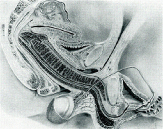 Reply to the post British scientists have proven again - NSFW, Sex, MRI, British scientists, The science, Science and life, Grey's Anatomy, Longpost