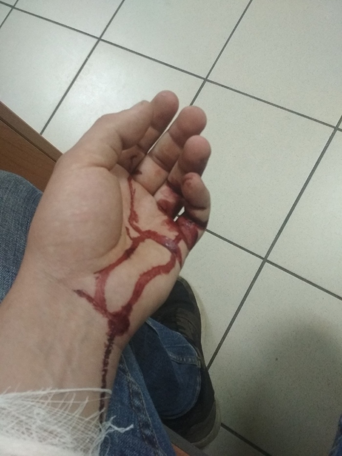 Hand not found ( 1) , , , , 