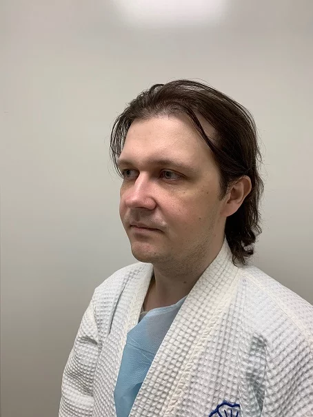 How my facelift ended, results 10 months later - My, Cosmetology, Men, beauty, Plastic surgery, The medicine, Appearance, Rosacea, Baldness, Longpost